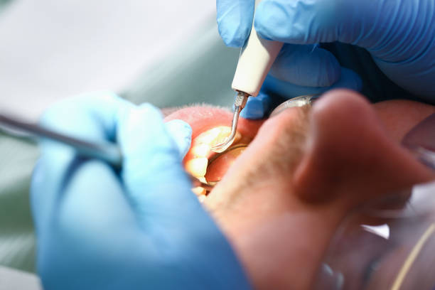 Best Same-Day Emergency Dentist in West Hammond, NM