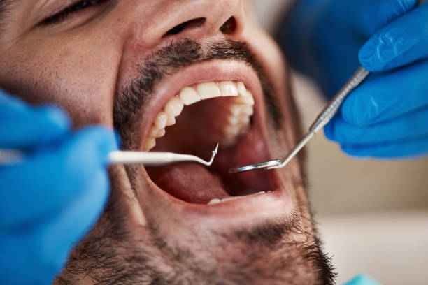 Best Pediatric Emergency Dentist in West Hammond, NM